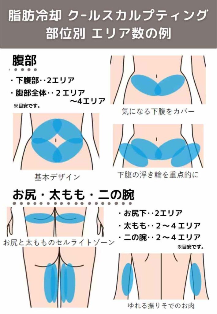 脂肪冷却クールスカルプティングの部位別エリア数の例を説明した図解